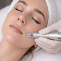 Microneedling
